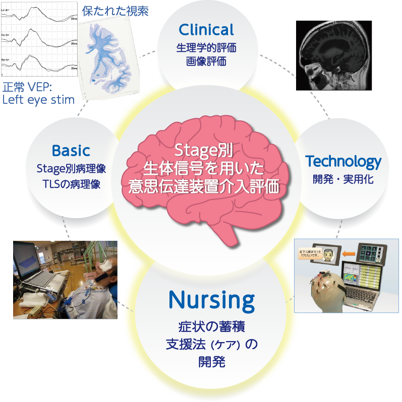 意思伝達維持に向けた集学的取組み意思伝達維持に向けた